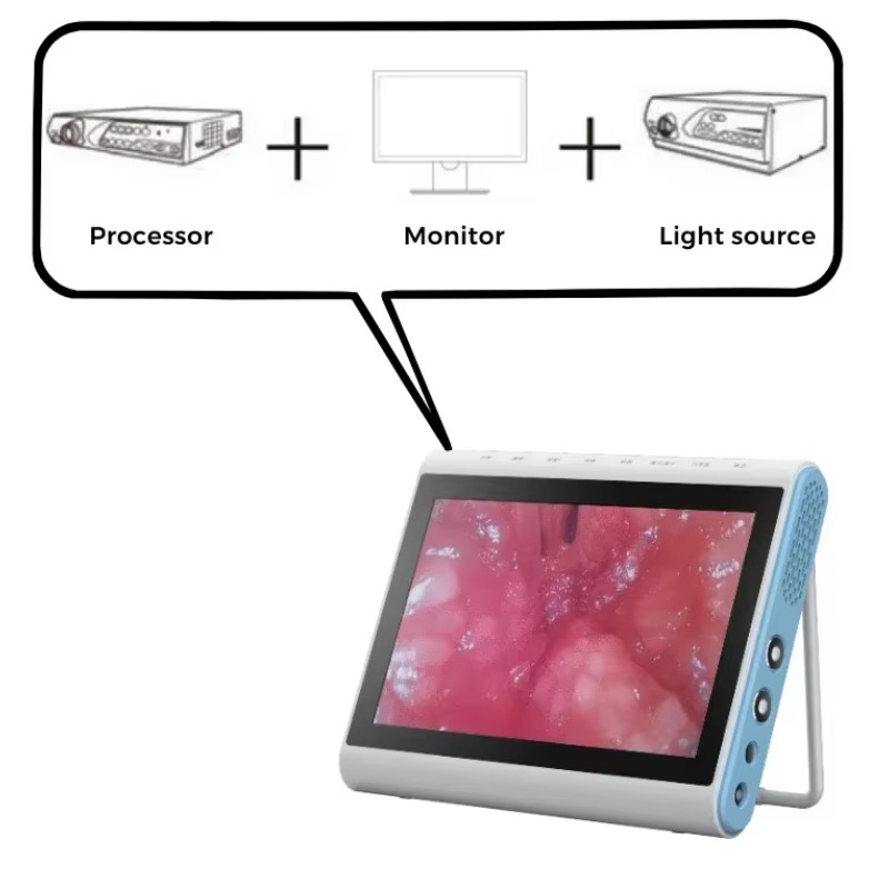 3‑In‑1 Medical Endoscopy Image - Medical Lab Images 评论和价格