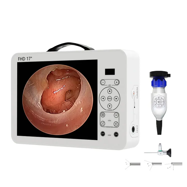 17 Inch HD Video Otoscope ENT  - Medical Lab Images 评论和价格