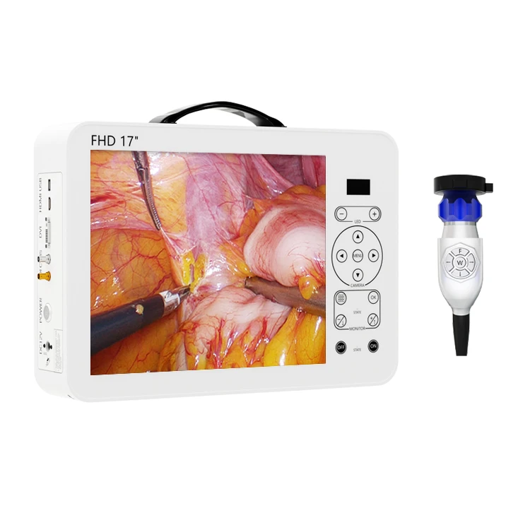 17 Inch HD Video Otoscope ENT  - Medical Lab Images 评论和价格